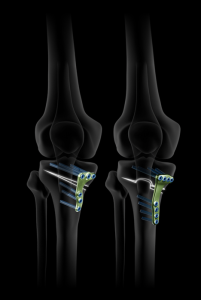 trueman male enhancement gummies » level1techs com